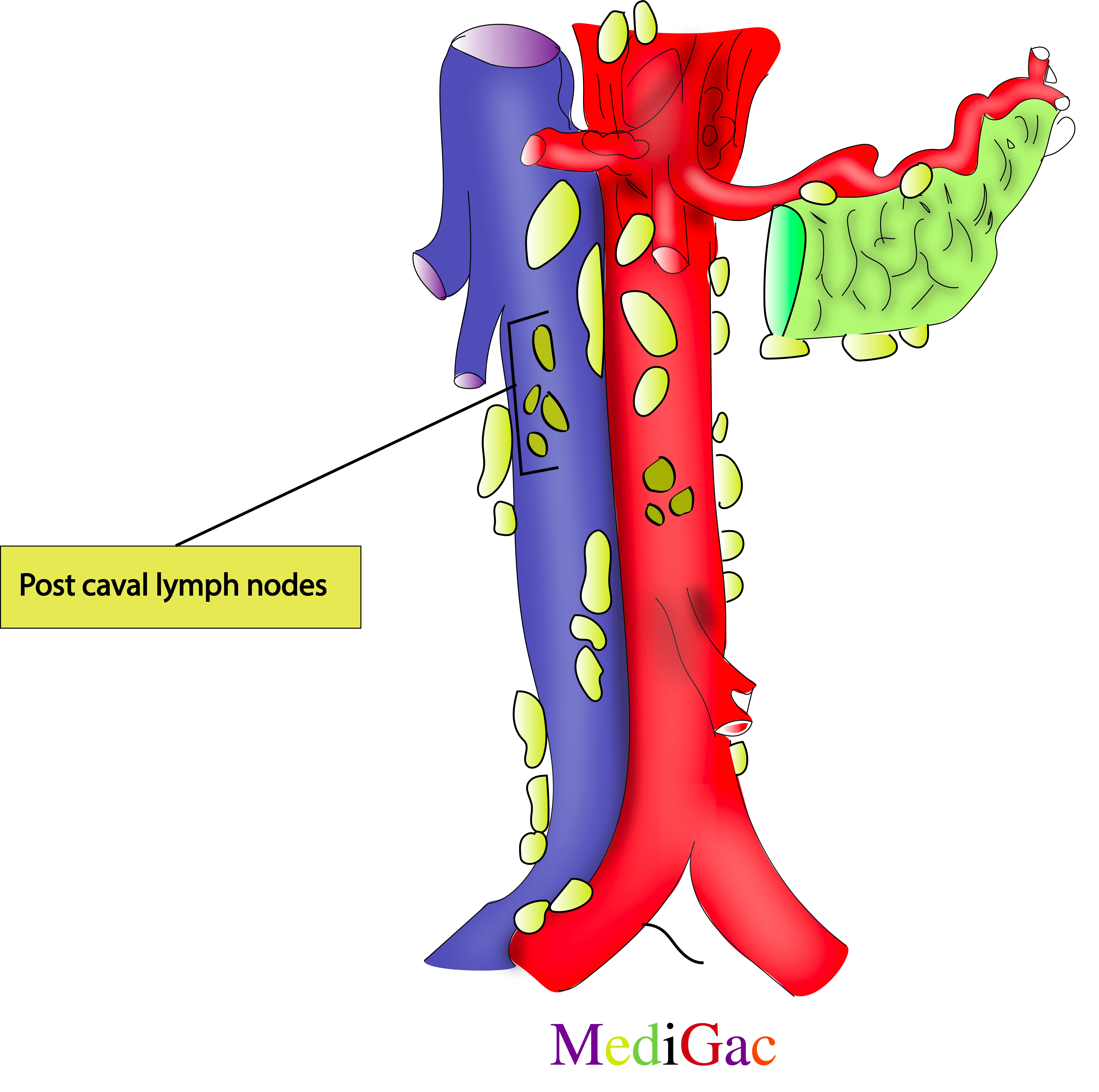 Post caval lymph nodes